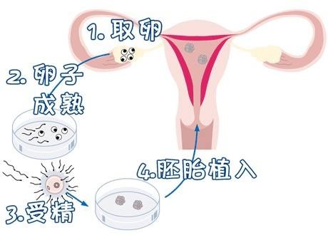 素竹生殖医学中心